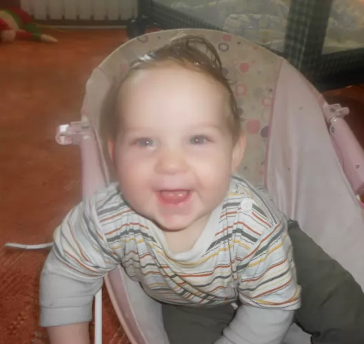 Koszmó eltávolítása Biocomos grapefruitmag kivonattal