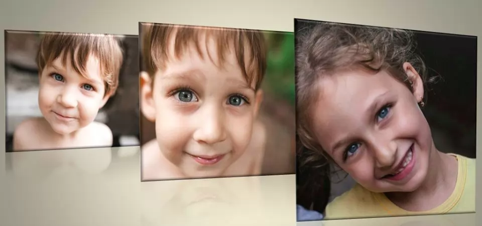 Az én történetem - ekcéma, autizmus