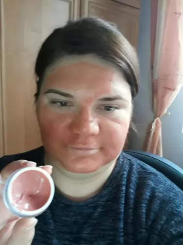 Szépítkezés - kollagén