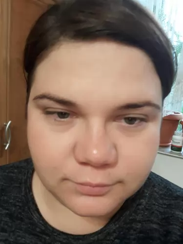 Szépítkezés - kollagén