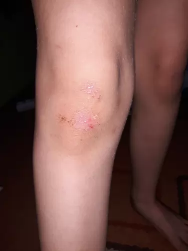 EGY CSEPP GRAPE - MINDEN NAPRA 🙂