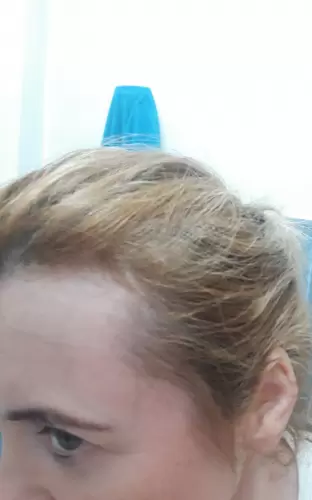 Hajnövekedésre kollagén