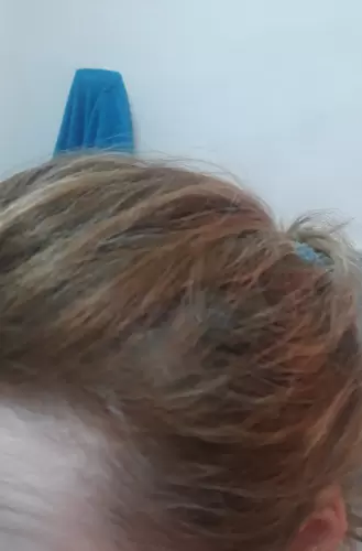 Hajnövekedésre kollagén