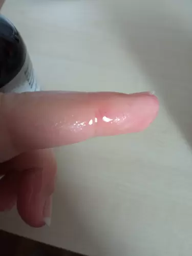 Mikor tövis megy a kezedbe