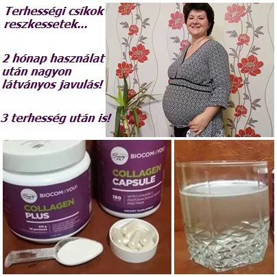 Terhességi csíkok reszkessetek!