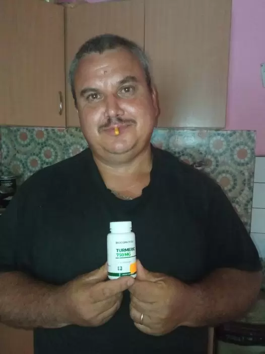 Csontfájás, gyulladások kezelése kurkumával