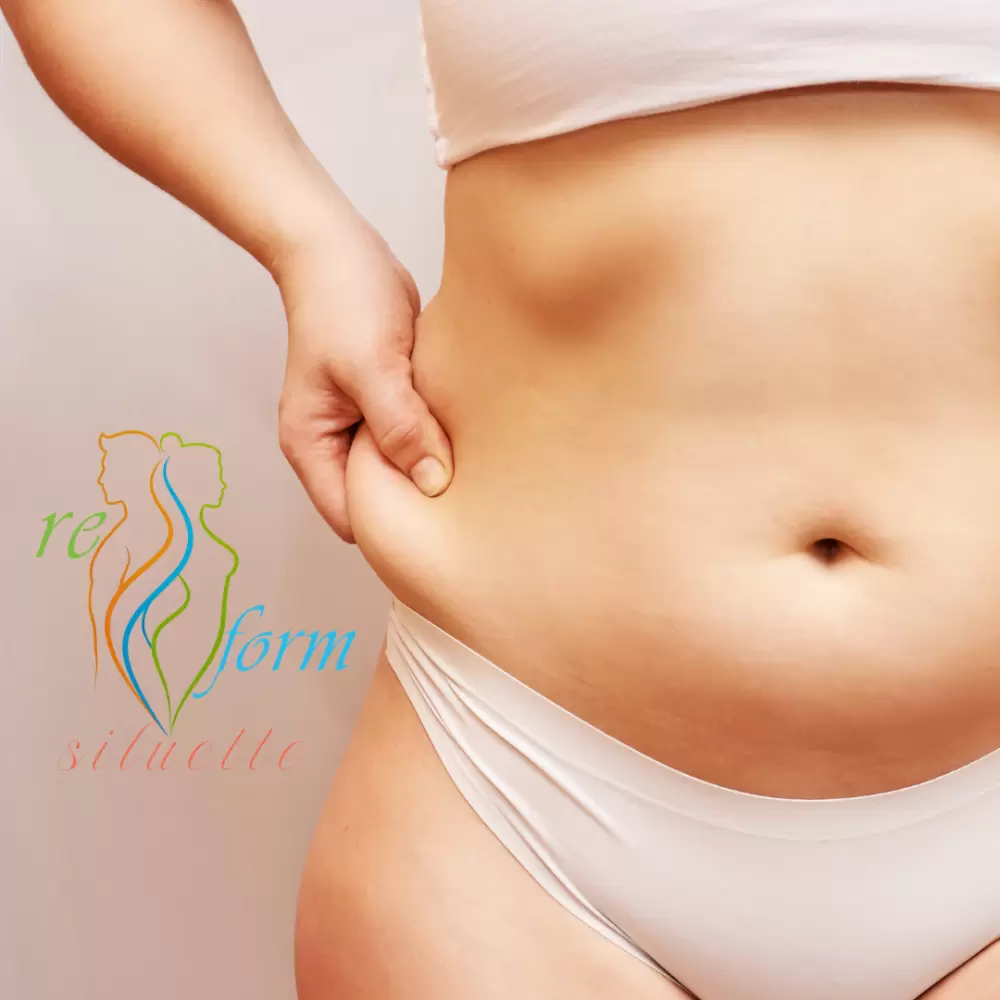 Ha felcsúszik pár kiló